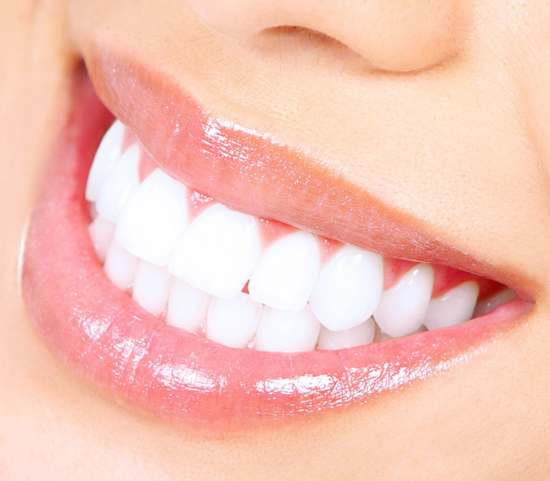 Dental Whitening in Forest Hills New York