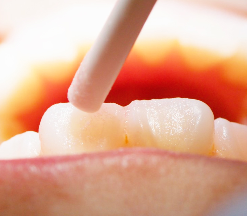 General Dentistry Sky Dental Care Forest Hills New York