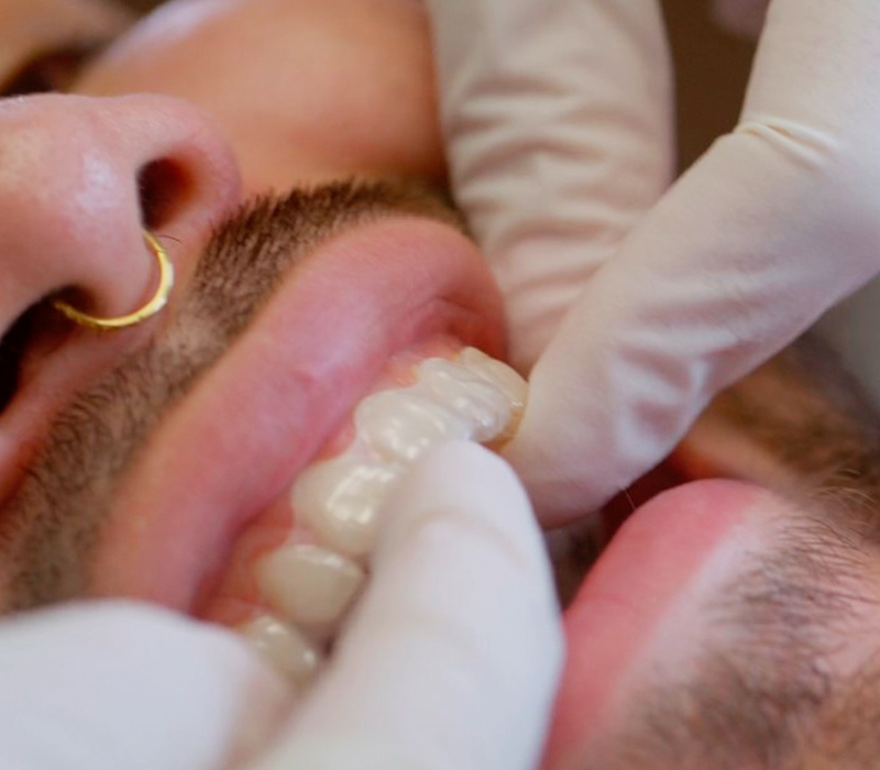 Sky Dental Care General Dentistry Forest Hills New York