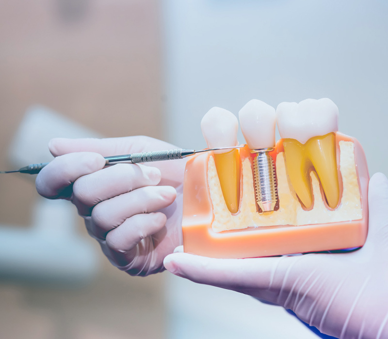 Sky Dental Care Implants and Dentures in Forest Hills New York